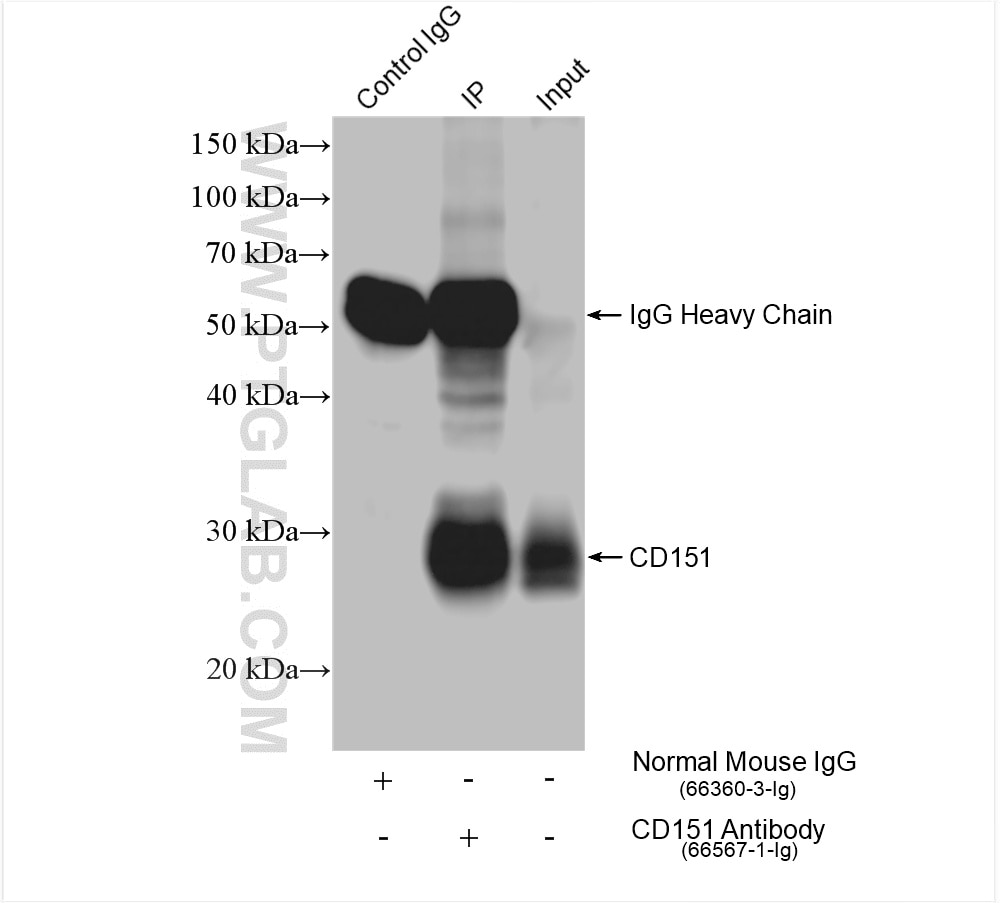 Immunoprecipitation (IP) experiment of human placenta tissue using CD151 Monoclonal antibody (66567-1-Ig)