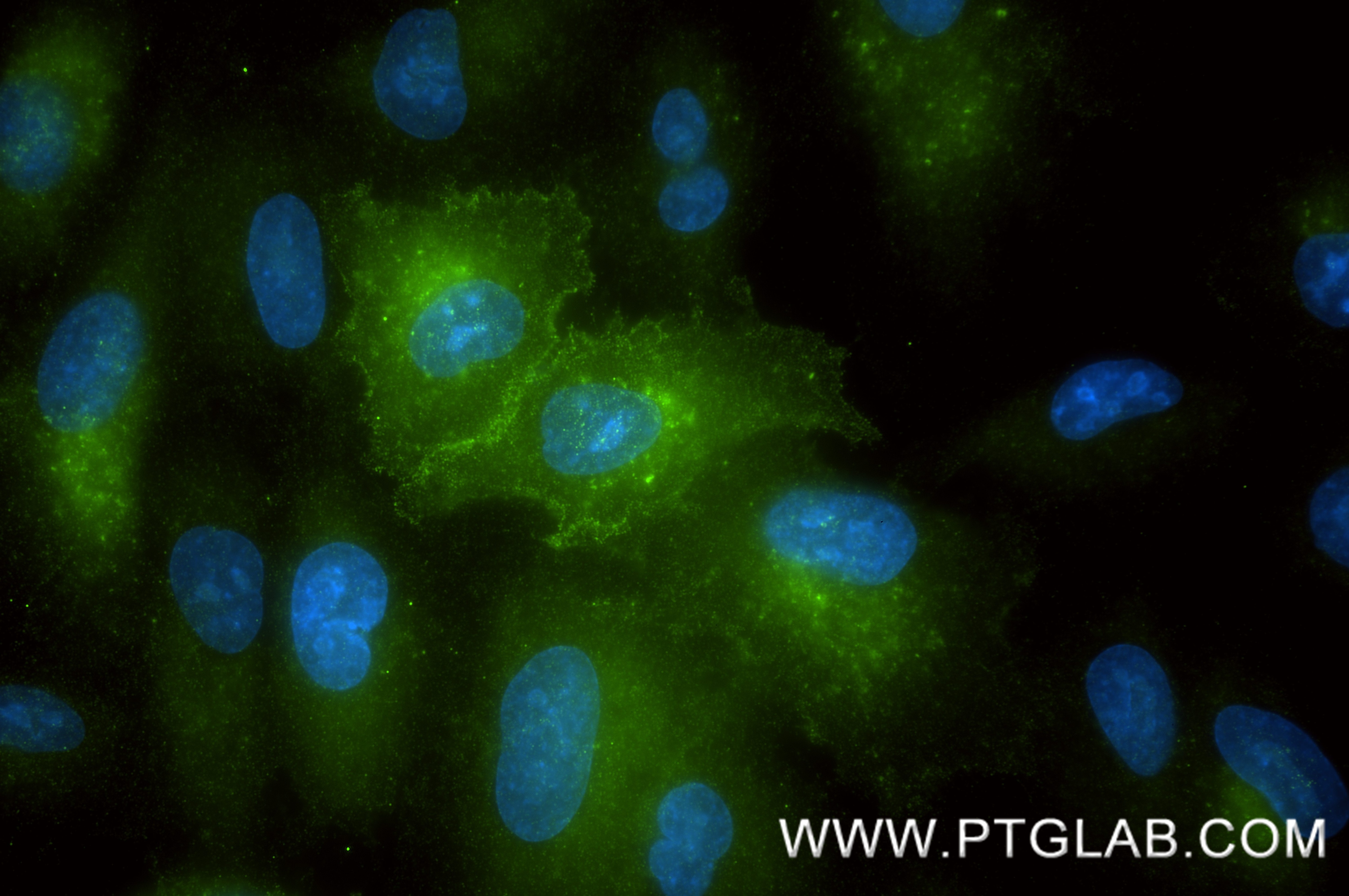 Immunofluorescence (IF) / fluorescent staining of A549 cells using CD151 Recombinant monoclonal antibody (85385-1-RR)