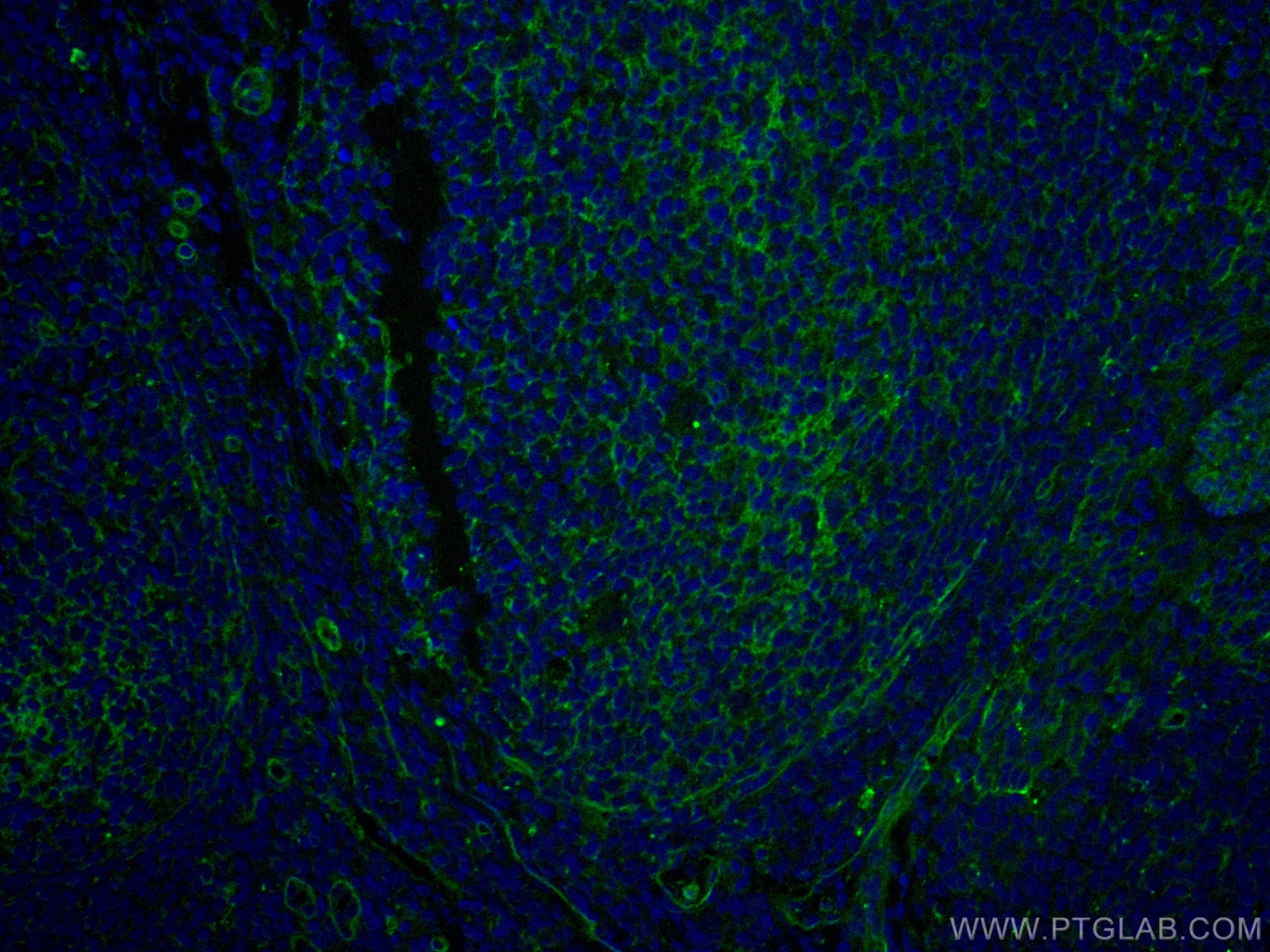 Immunofluorescence (IF) / fluorescent staining of human tonsillitis tissue using CoraLite®488-conjugated CD151 Monoclonal antibody (CL488-66567)