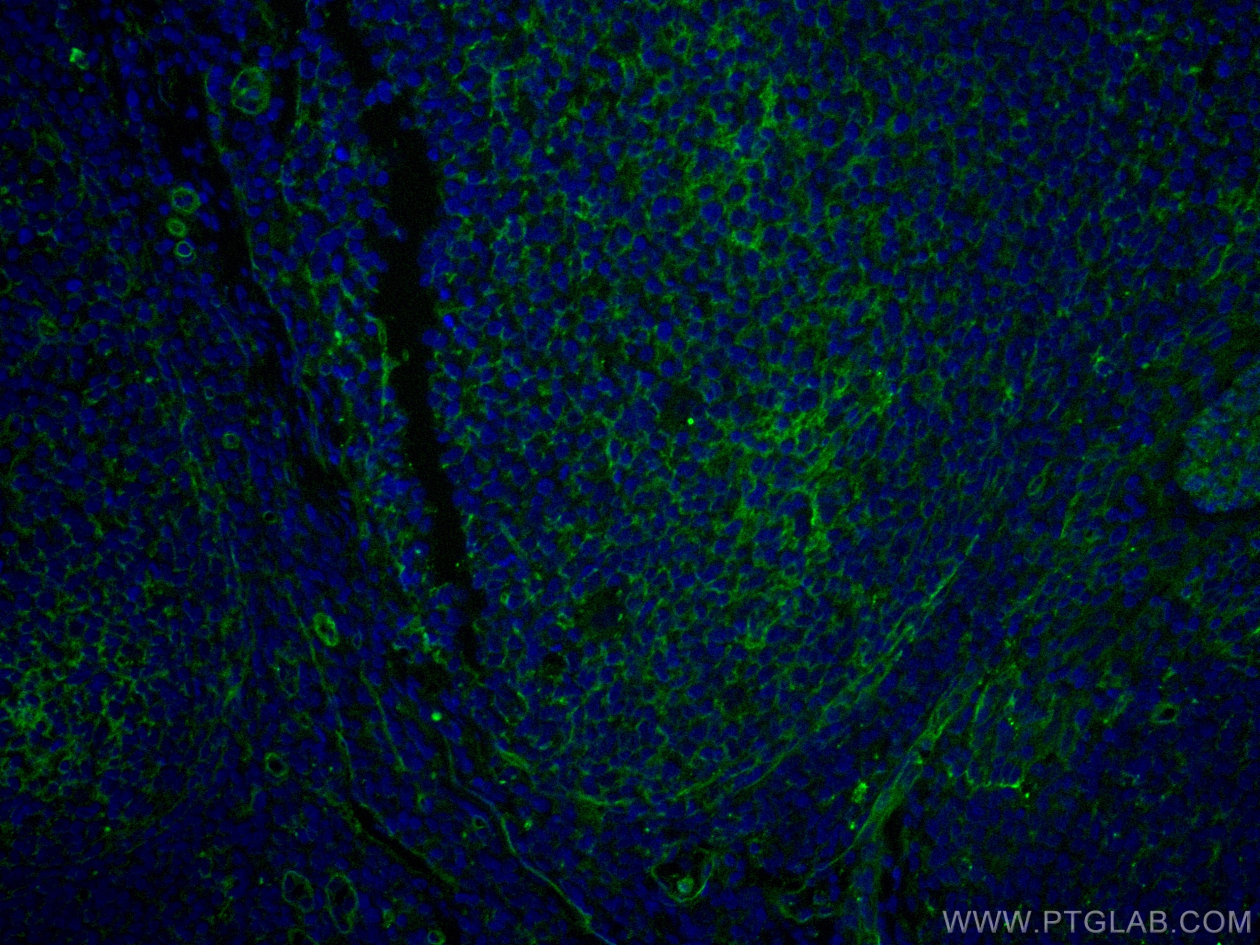 IF Staining of human tonsillitis using CL488-66567