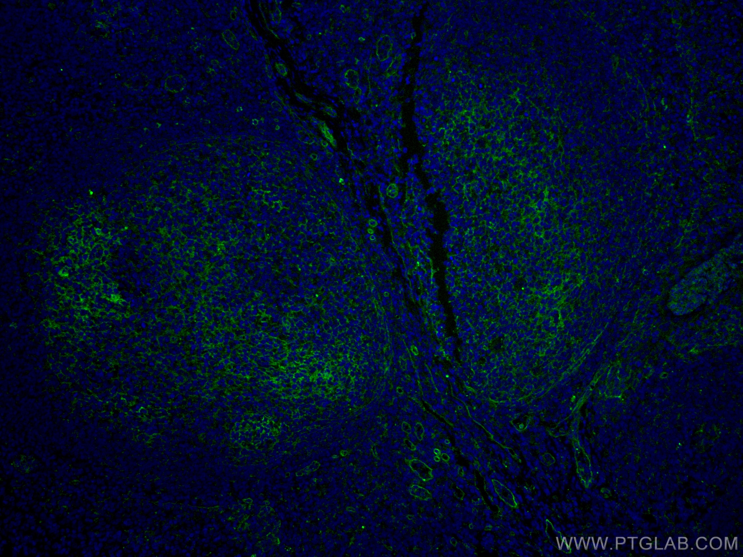 Immunofluorescence (IF) / fluorescent staining of human tonsillitis tissue using CoraLite®488-conjugated CD151 Monoclonal antibody (CL488-66567)