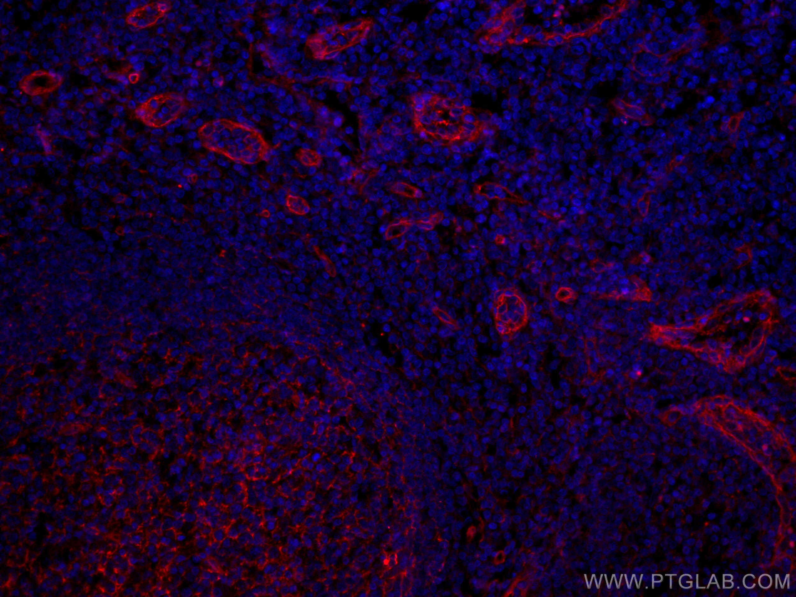 Immunofluorescence (IF) / fluorescent staining of human tonsillitis tissue using CoraLite®594-conjugated CD151 Monoclonal antibody (CL594-66567)