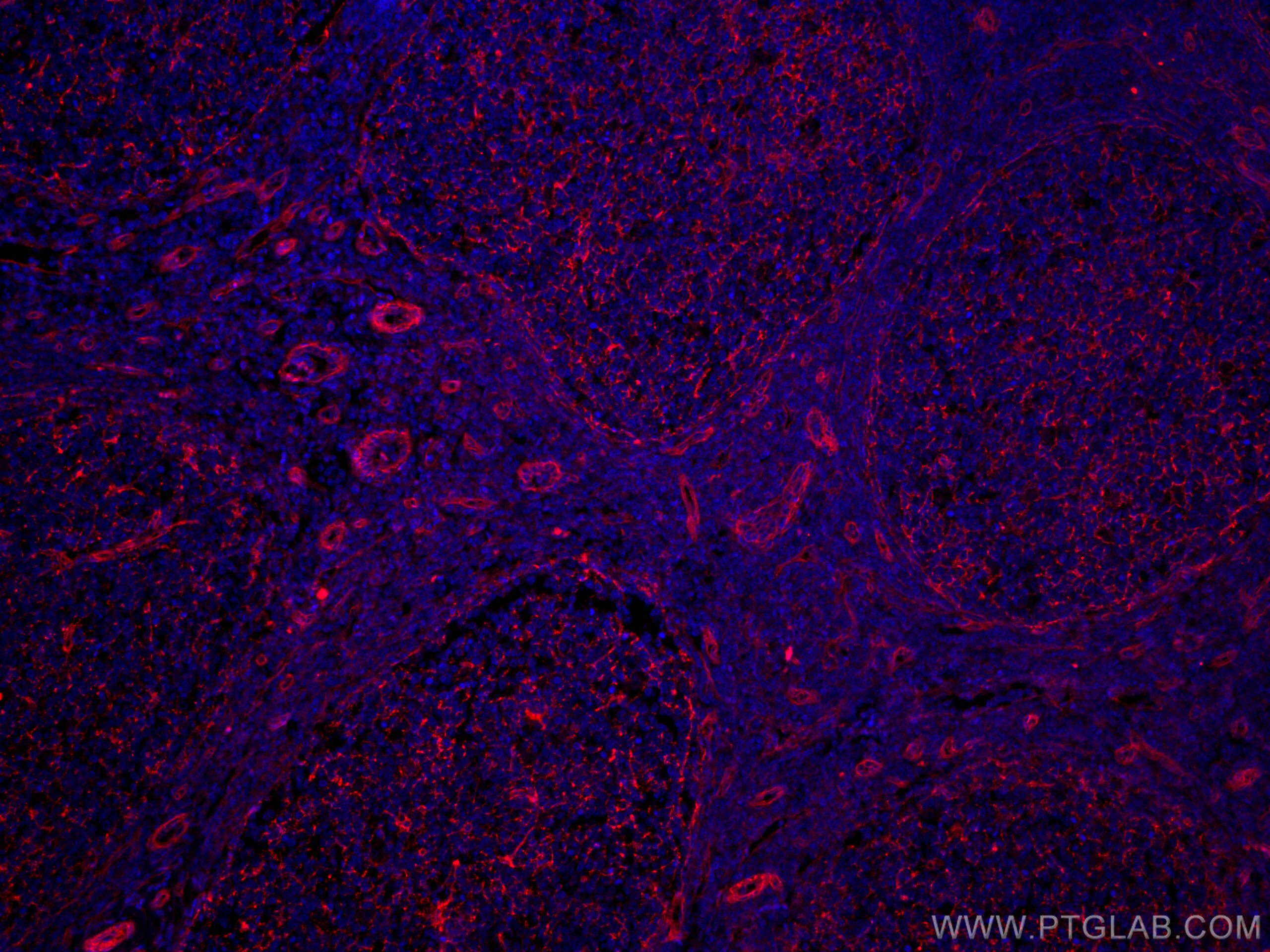 Immunofluorescence (IF) / fluorescent staining of human tonsillitis tissue using CoraLite®594-conjugated CD151 Monoclonal antibody (CL594-66567)
