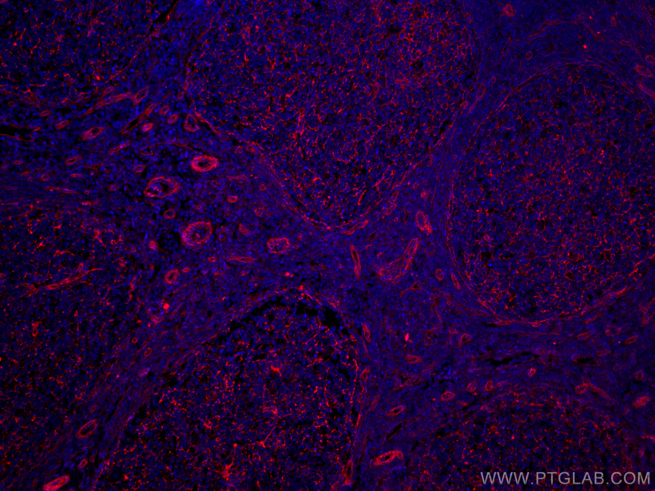 Immunofluorescence (IF) / fluorescent staining of human tonsillitis tissue using CoraLite®594-conjugated CD151 Monoclonal antibody (CL594-66567)