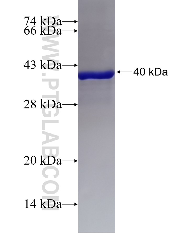 CD151 fusion protein Ag25968 SDS-PAGE