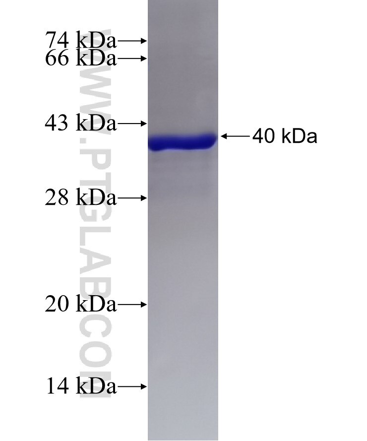 CD151 fusion protein Ag25968 SDS-PAGE