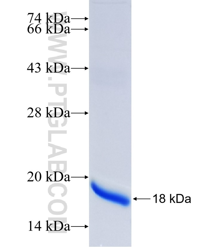 CD151 fusion protein Ag25985 SDS-PAGE