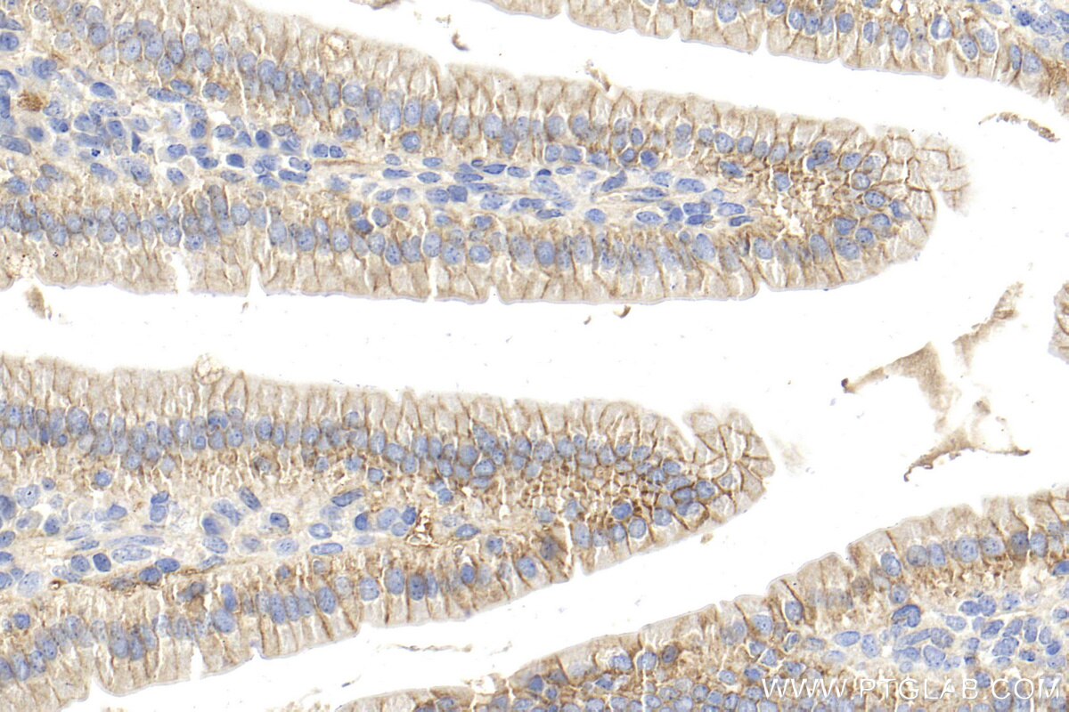 Immunohistochemistry (IHC) staining of mouse small intestine tissue using CD155/PVR Polyclonal antibody (31447-1-AP)