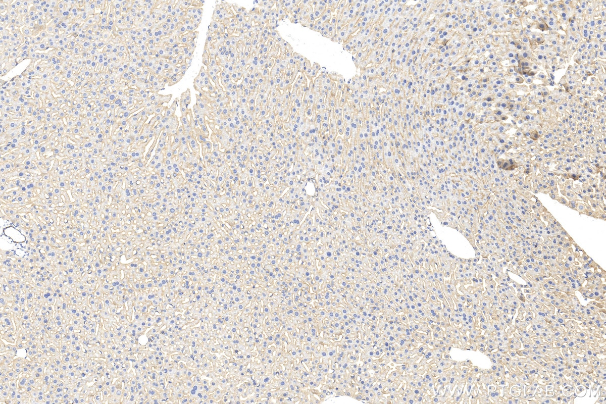 Immunohistochemistry (IHC) staining of mouse liver tissue using CD155/PVR Polyclonal antibody (31447-1-AP)