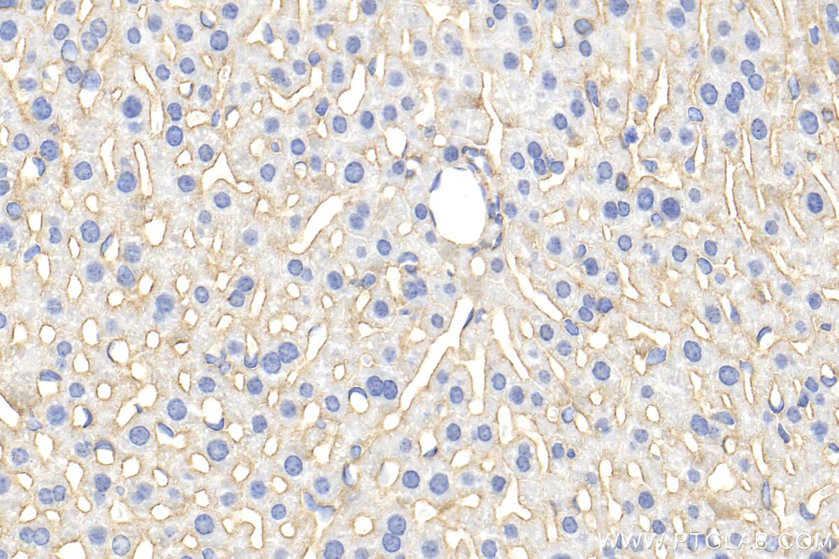 Immunohistochemistry (IHC) staining of mouse liver tissue using CD155/PVR Polyclonal antibody (31447-1-AP)