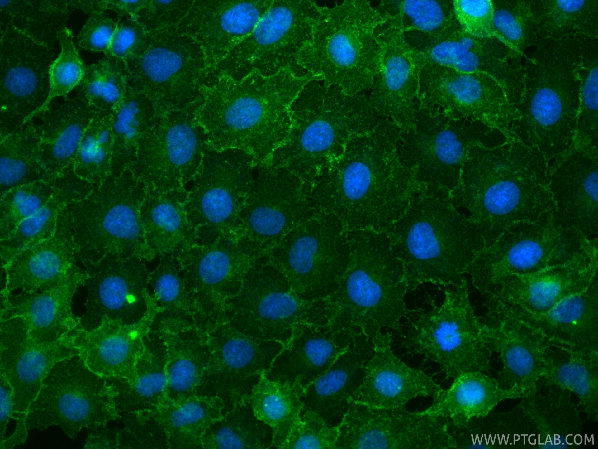 Immunofluorescence (IF) / fluorescent staining of A549 cells using CD155/PVR Recombinant monoclonal antibody (84138-1-RR)