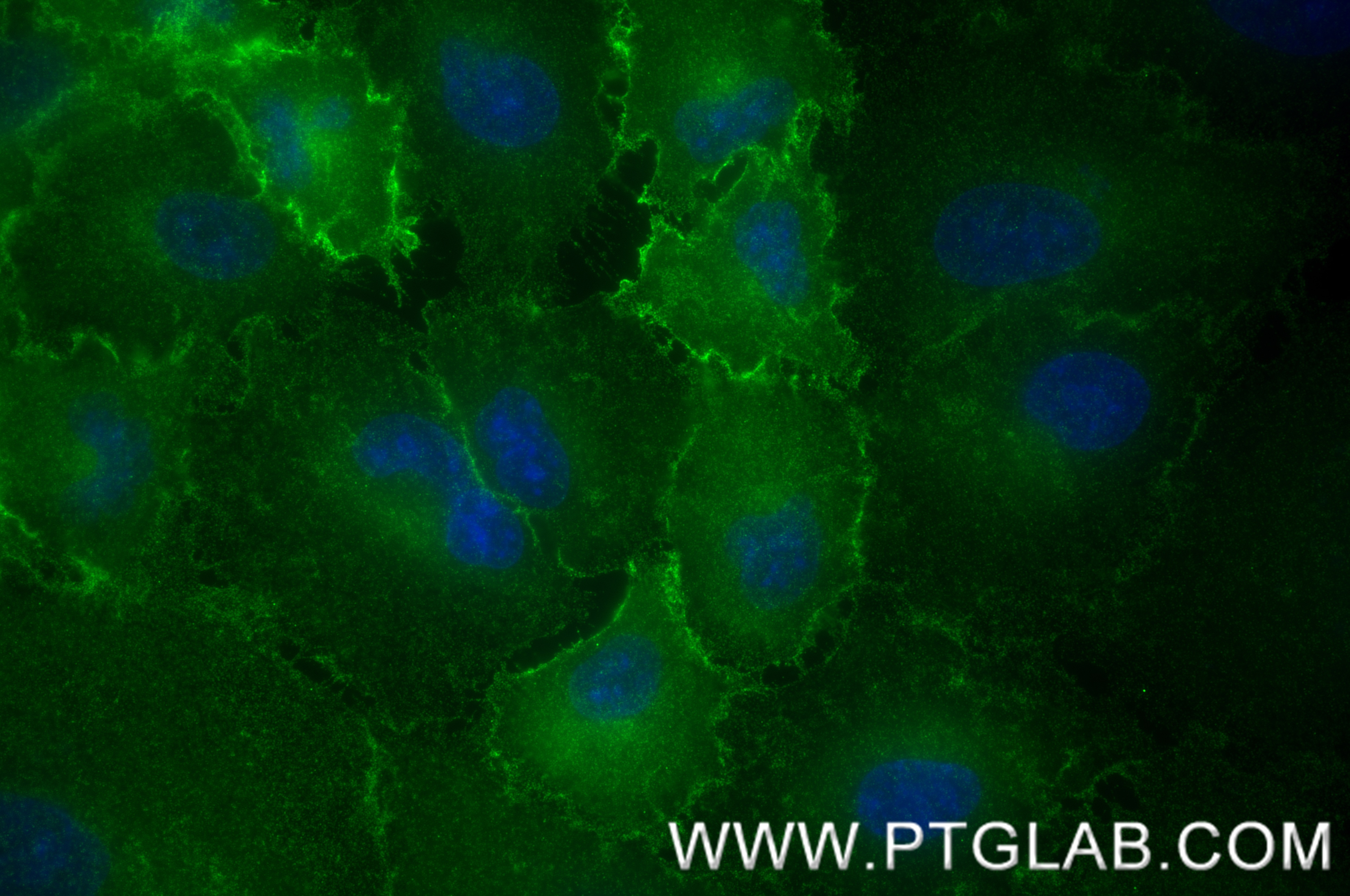 Immunofluorescence (IF) / fluorescent staining of A549 cells using CD155/PVR Recombinant antibody (84138-5-RR)
