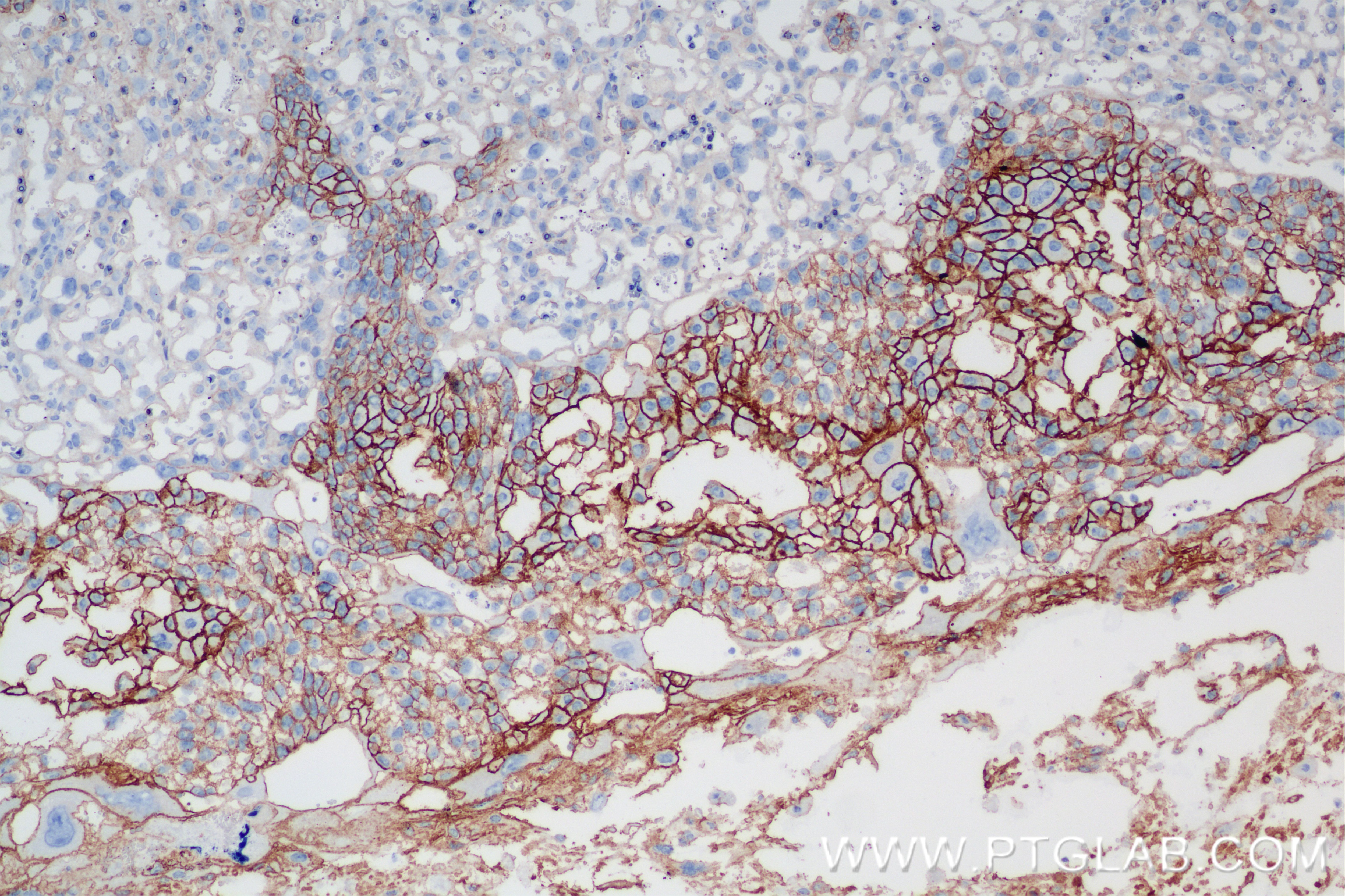Immunohistochemistry (IHC) staining of mouse placenta tissue using CD155/PVR Recombinant antibody (85006-1-RR)