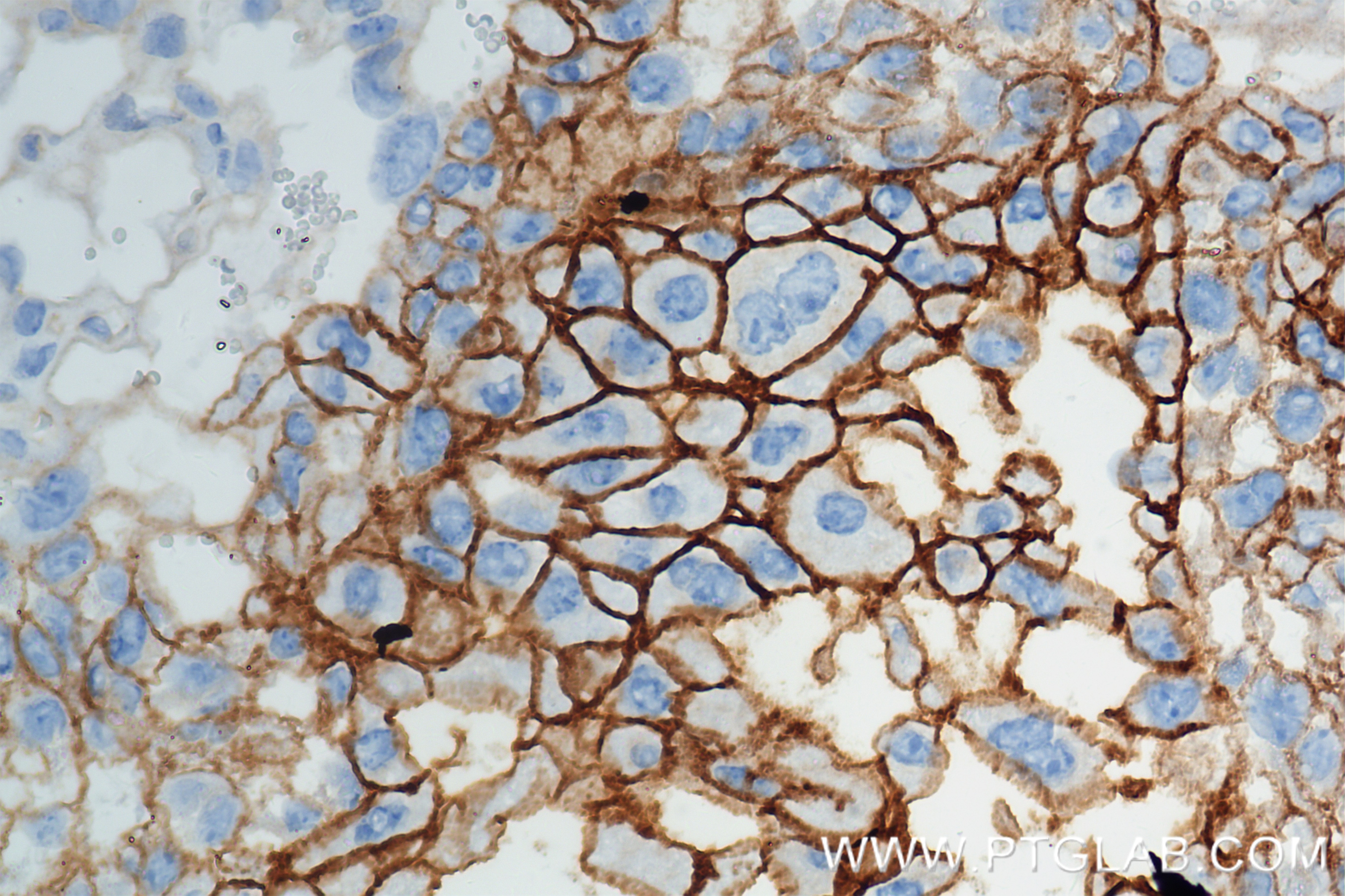 Immunohistochemistry (IHC) staining of mouse placenta tissue using CD155/PVR Recombinant antibody (85006-1-RR)