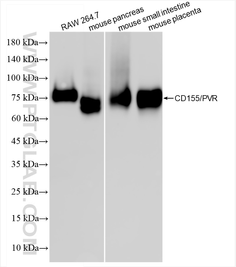 Western Blot (WB) analysis of various lysates using CD155/PVR Recombinant antibody (85006-1-RR)