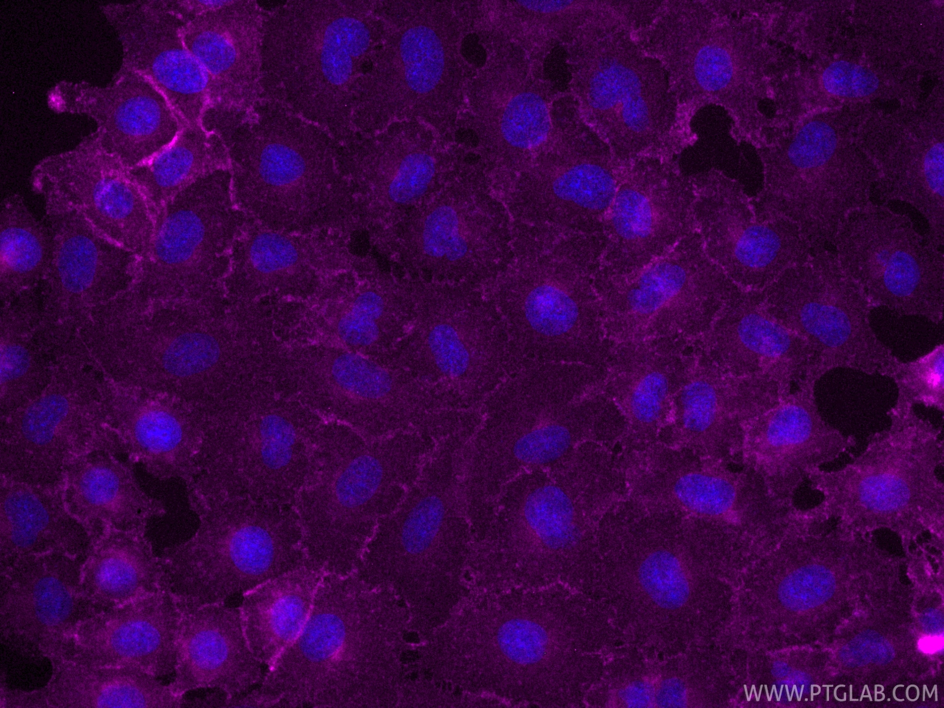 Immunofluorescence (IF) / fluorescent staining of A549 cells using CoraLite® Plus 647-conjugated CD155/PVR Recombinan (CL647-84138)