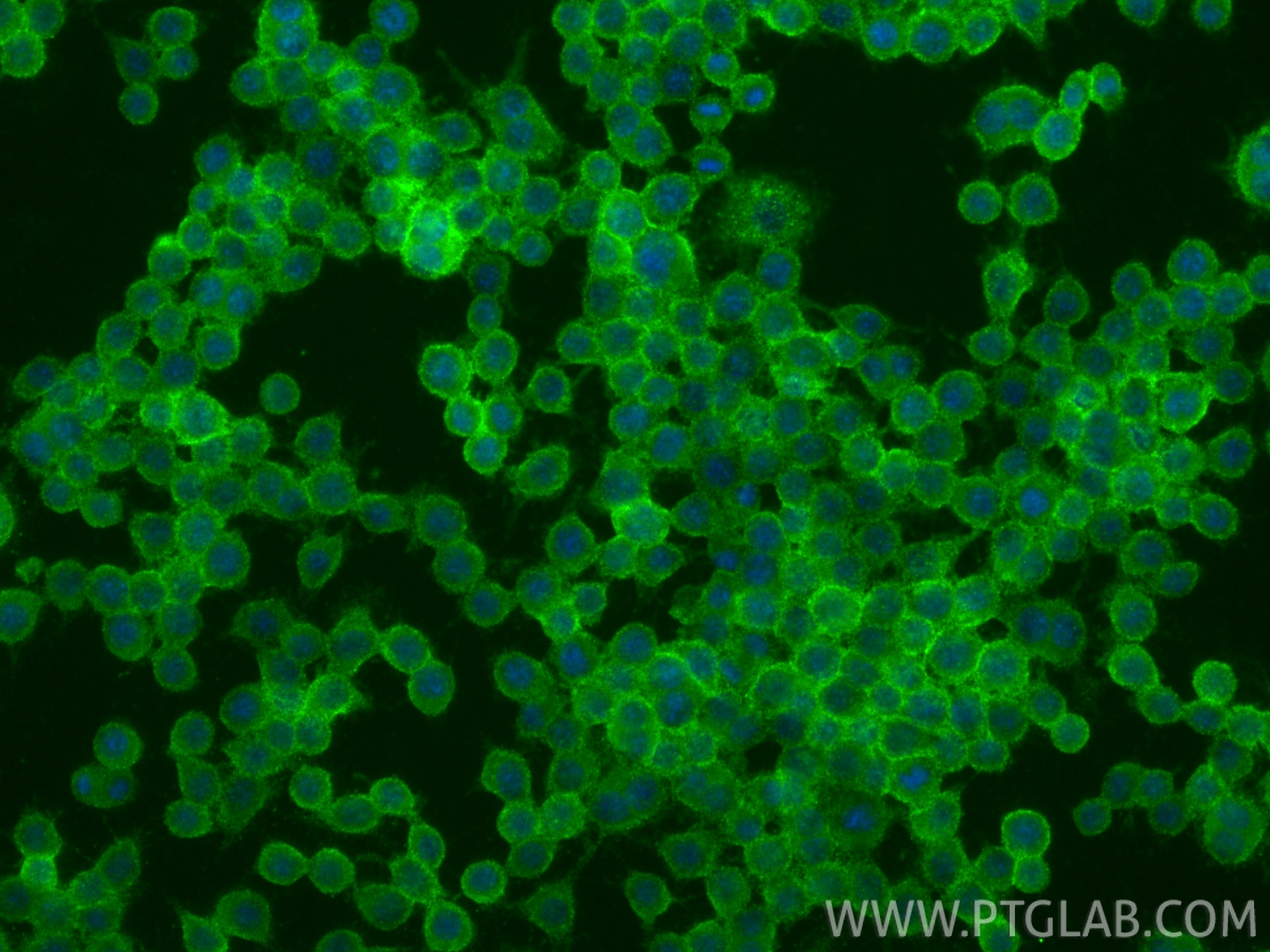 Immunofluorescence (IF) / fluorescent staining of RAW 264.7 cells using CD157 Recombinant monoclonal antibody (84417-5-RR)
