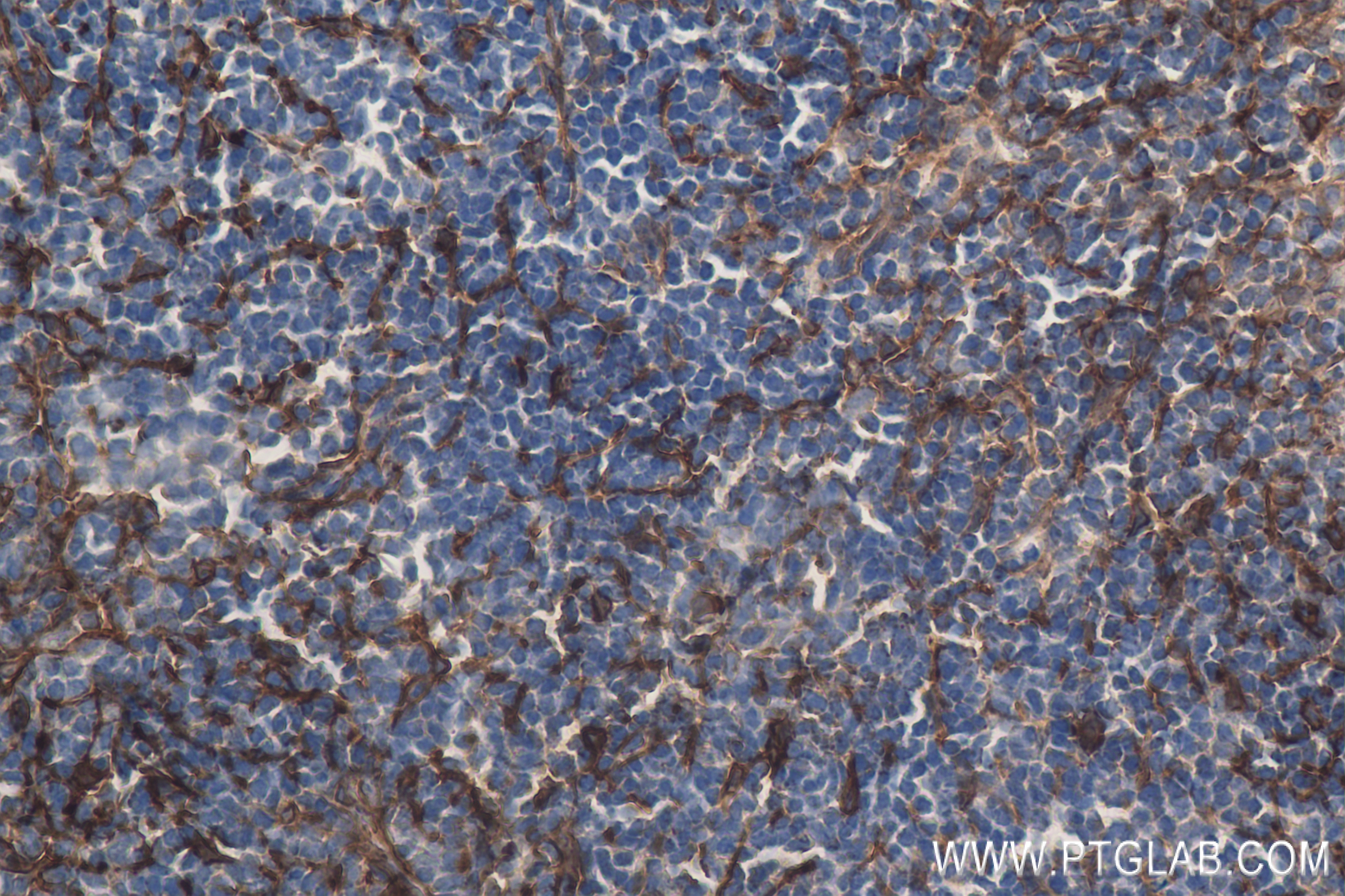Immunohistochemistry (IHC) staining of mouse spleen tissue using CD157 Recombinant antibody (84417-5-RR)