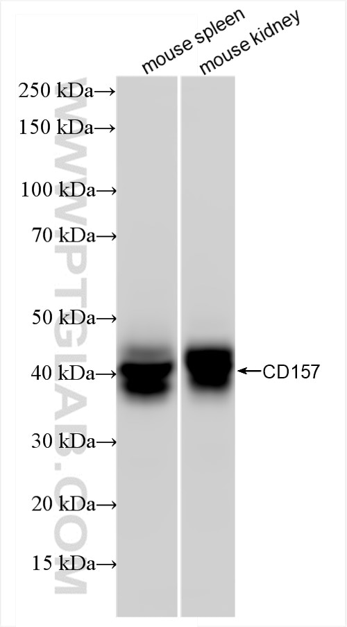 Western Blot (WB) analysis of various lysates using CD157 Recombinant antibody (84417-5-RR)