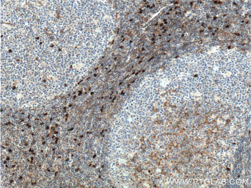 Immunohistochemistry (IHC) staining of human tonsillitis tissue using CD16 Polyclonal antibody (16559-1-AP)