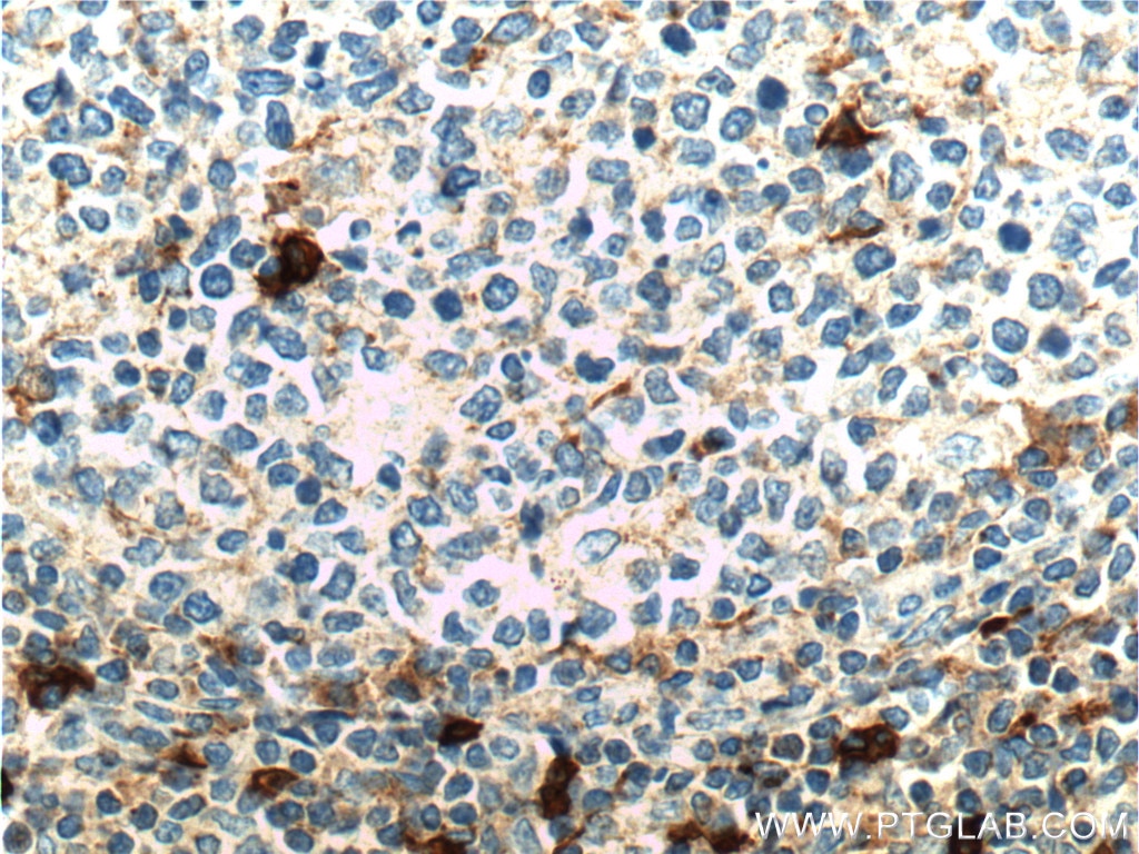 Immunohistochemistry (IHC) staining of human tonsillitis tissue using CD16 Polyclonal antibody (16559-1-AP)