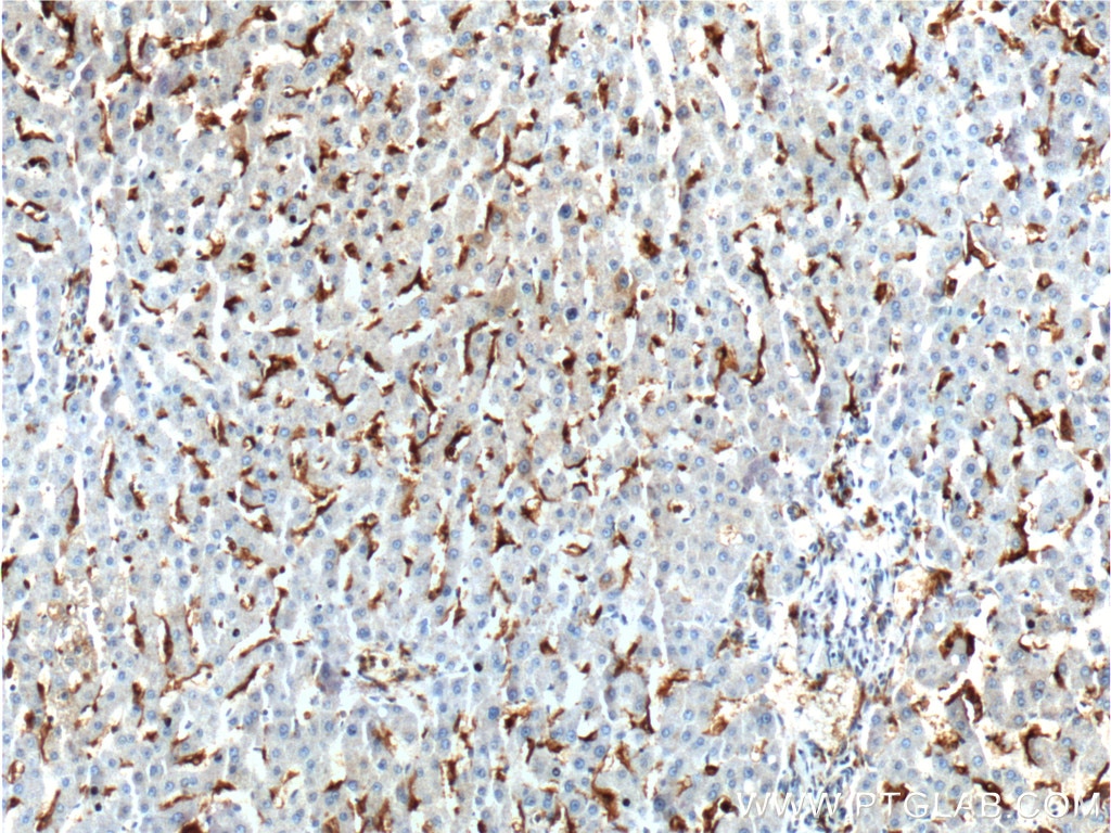 Immunohistochemistry (IHC) staining of human liver tissue using CD16 Polyclonal antibody (16559-1-AP)