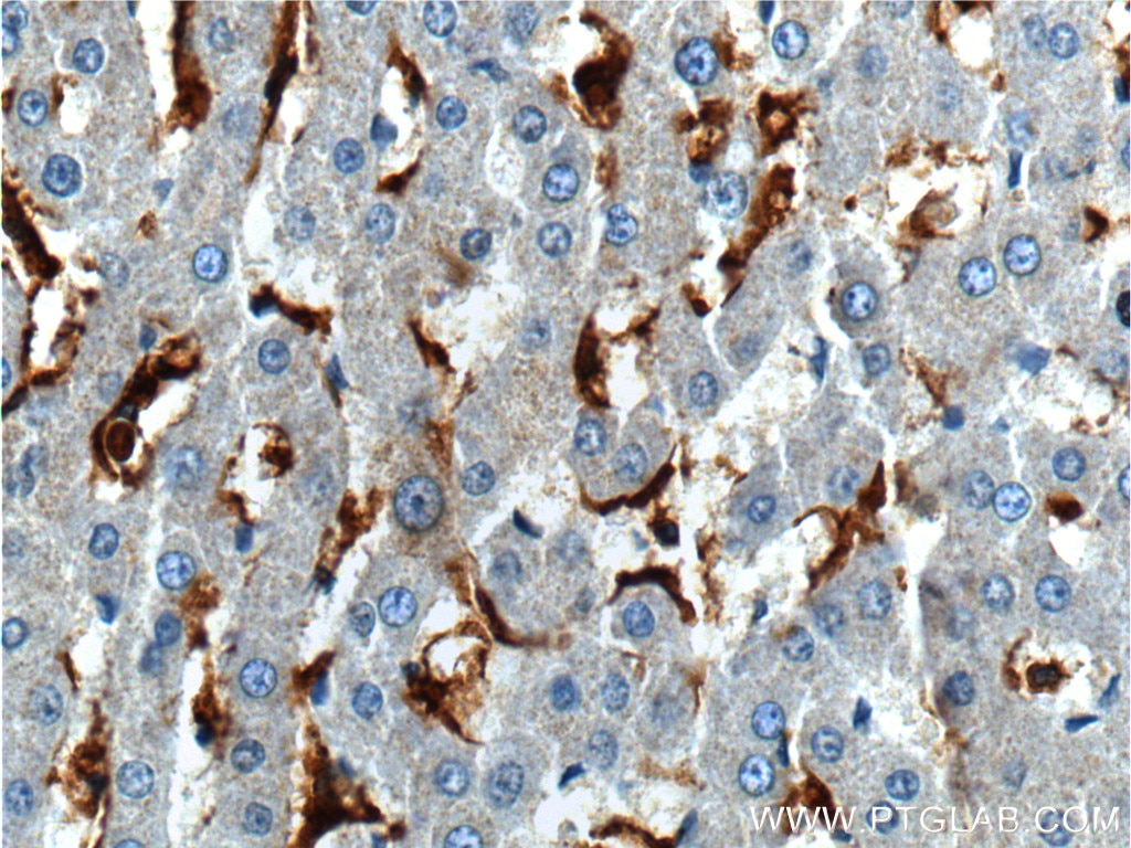 Immunohistochemistry (IHC) staining of human liver tissue using CD16 Polyclonal antibody (16559-1-AP)