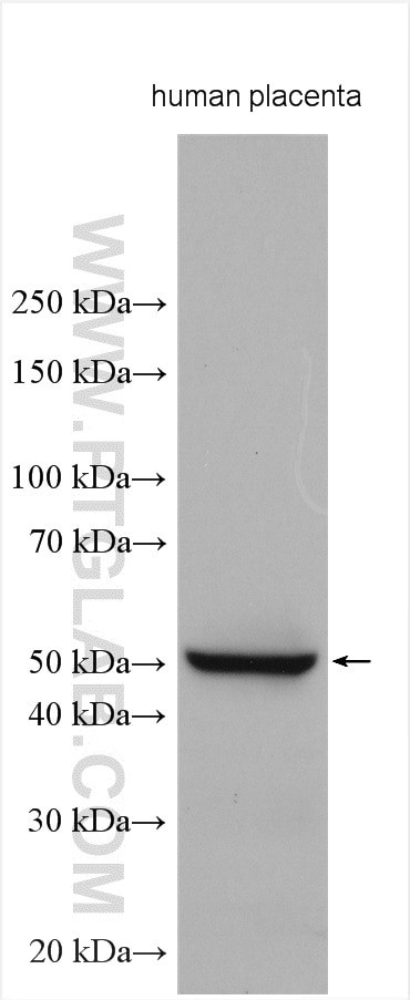 Western Blot (WB) analysis of various lysates using CD16 Polyclonal antibody (16559-1-AP)