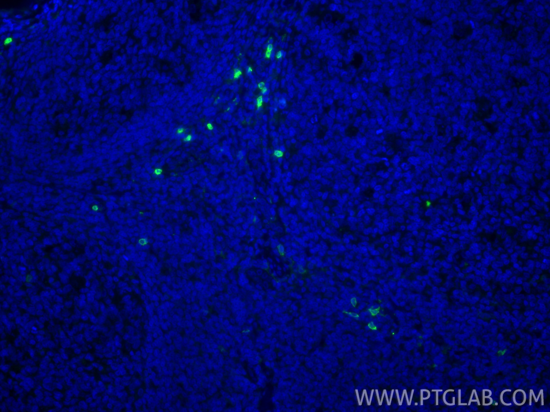 Immunofluorescence (IF) / fluorescent staining of human tonsillitis tissue using CD16 Polyclonal antibody (30567-1-AP)