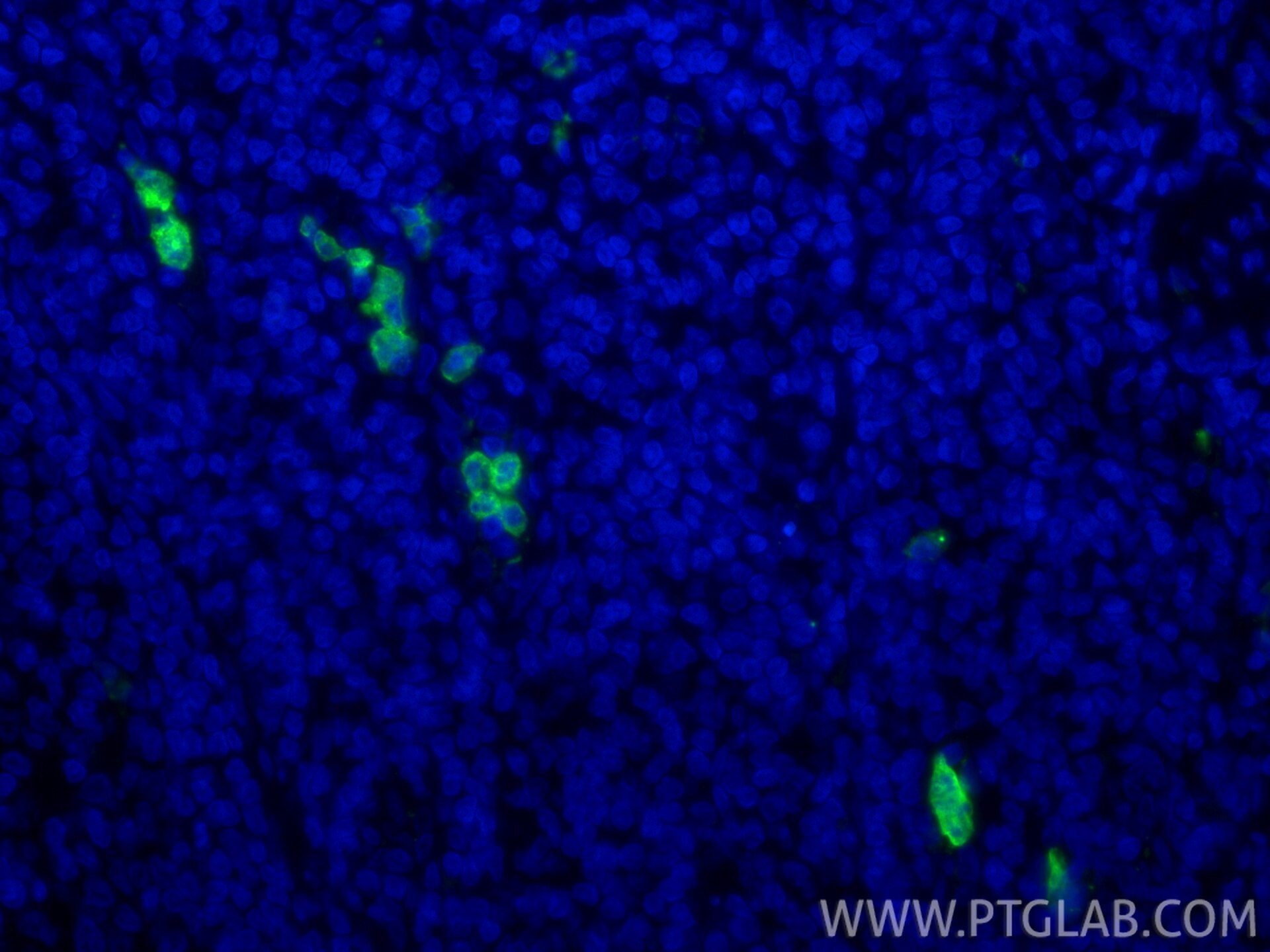 Immunofluorescence (IF) / fluorescent staining of human tonsillitis tissue using CD16 Polyclonal antibody (30567-1-AP)