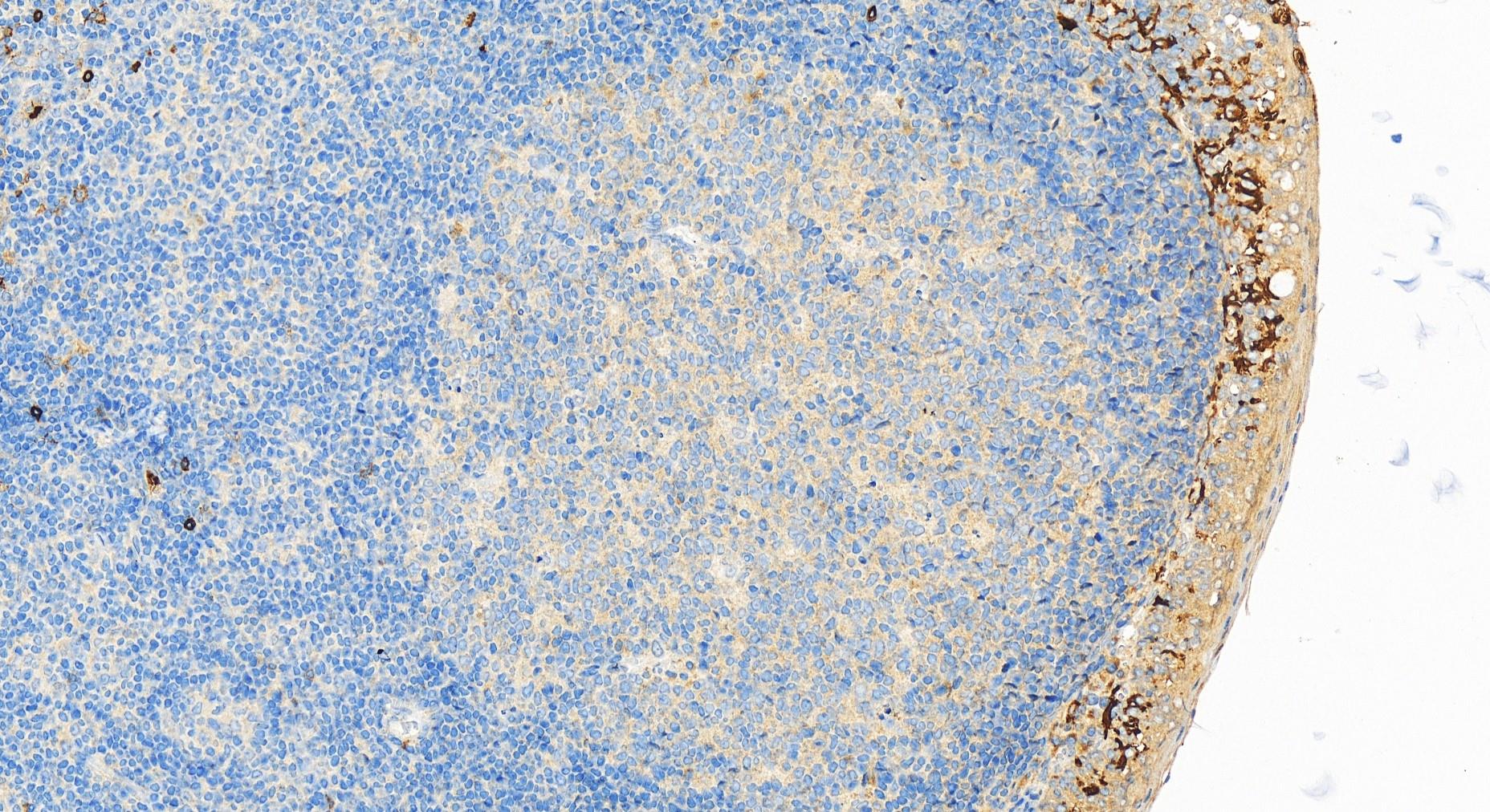 Immunohistochemistry (IHC) staining of human tonsillitis tissue using CD16 Polyclonal antibody (30567-1-AP)