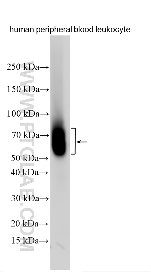 Western Blot (WB) analysis of various lysates using CD16 Polyclonal antibody (30567-1-AP)