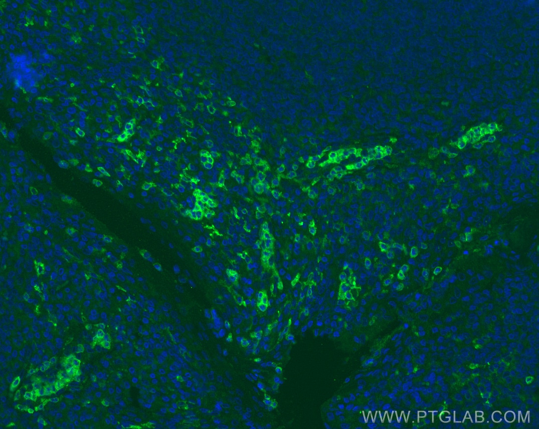 Immunofluorescence (IF) / fluorescent staining of human tonsillitis tissue using CD16 Monoclonal antibody (66779-1-Ig)