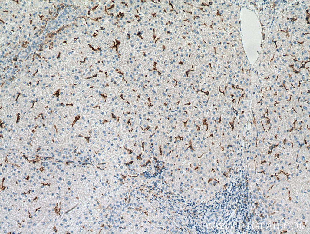Immunohistochemistry (IHC) staining of human liver tissue using CD16 Monoclonal antibody (66779-1-Ig)