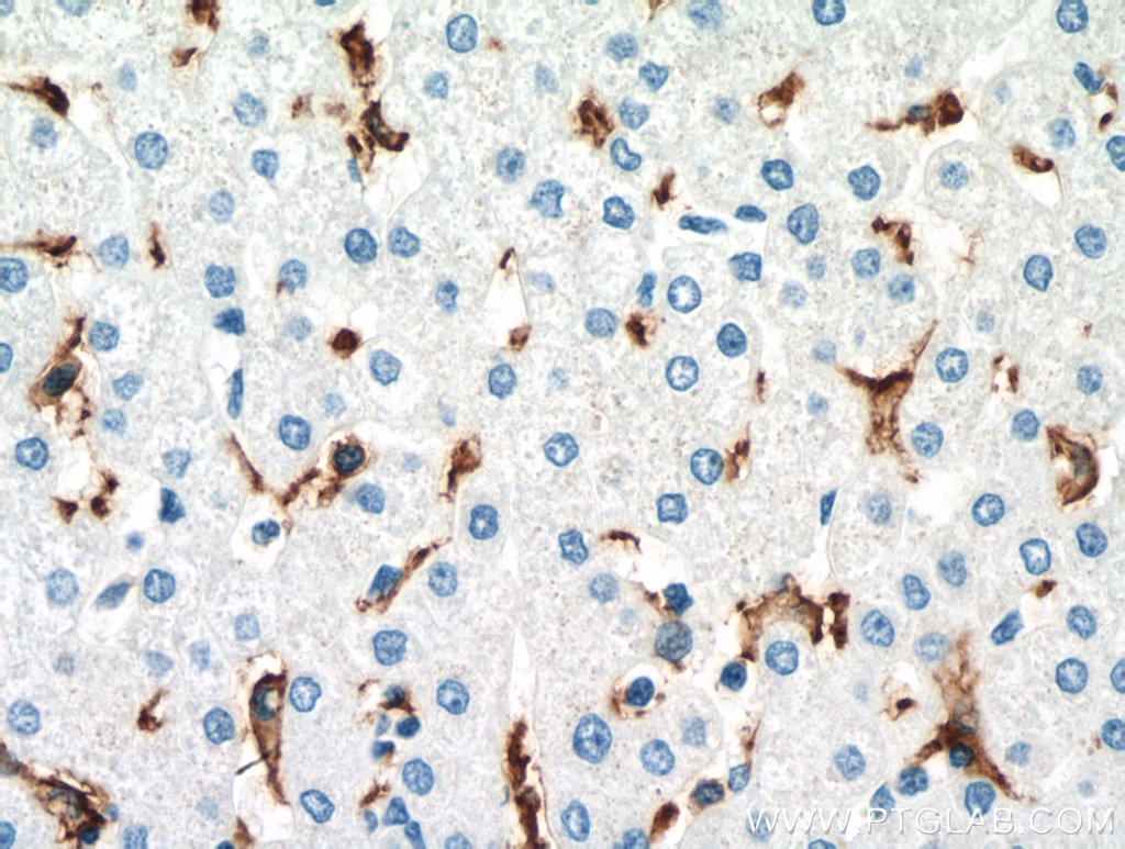 Immunohistochemistry (IHC) staining of human liver tissue using CD16 Monoclonal antibody (66779-1-Ig)