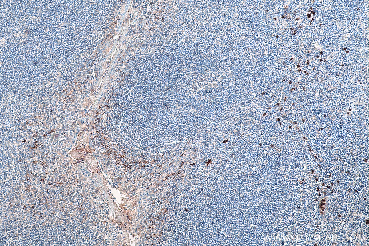 Immunohistochemistry (IHC) staining of human tonsillitis tissue using CD16 Monoclonal antibody (66779-1-Ig)