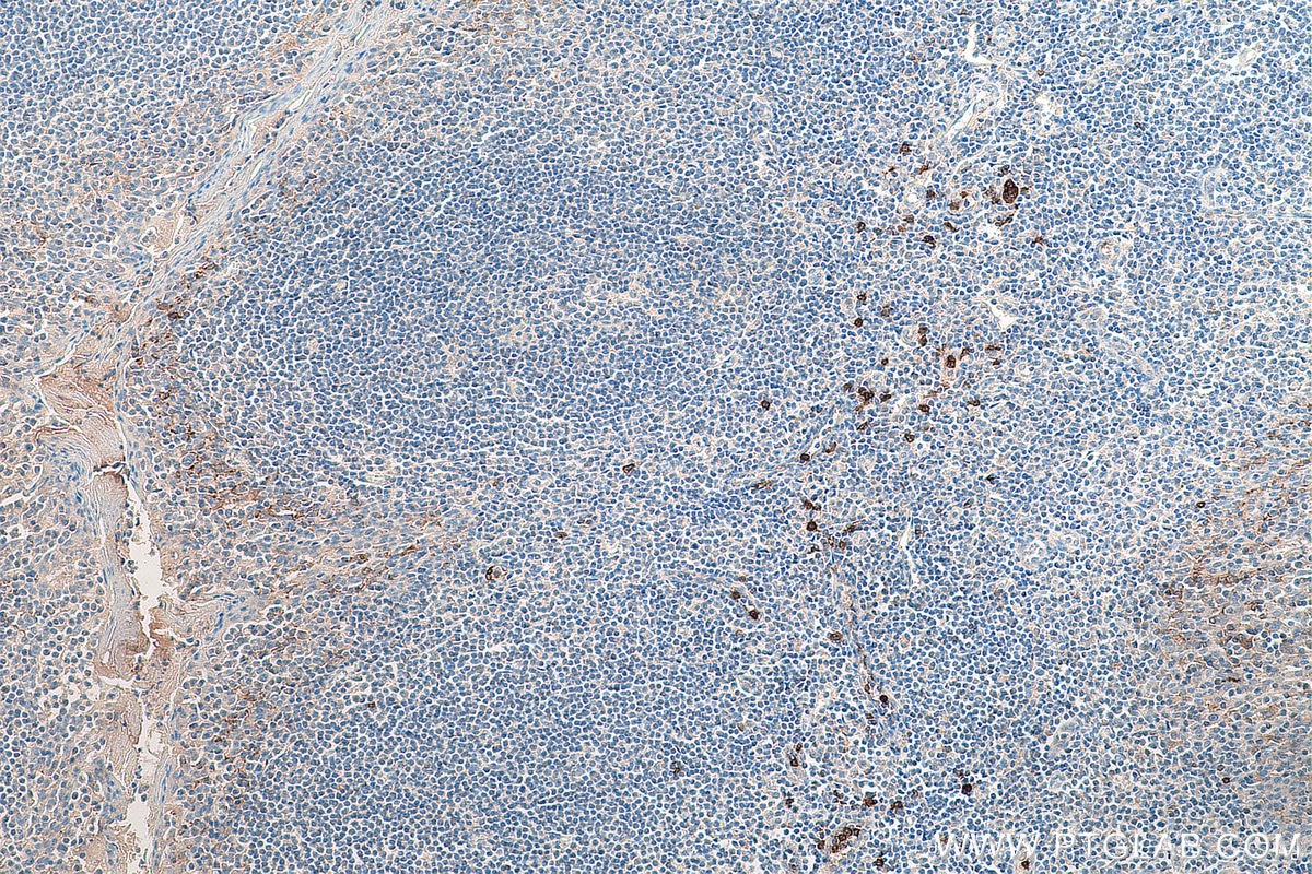 Immunohistochemistry (IHC) staining of human tonsillitis tissue using CD16 Monoclonal antibody (66779-1-Ig)