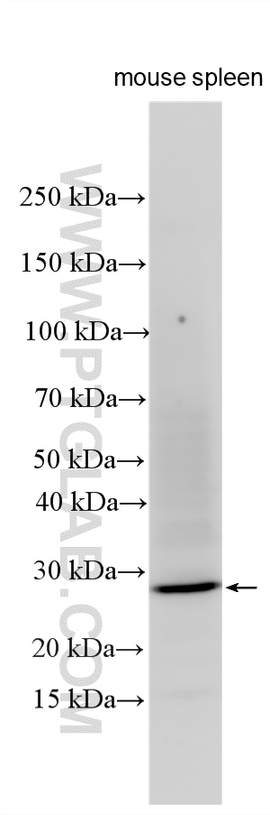 WB analysis using 34143-1-AP Western Blot (WB) analysis of various lysates using CD160 Polyclonal antibody (34143-1-AP)