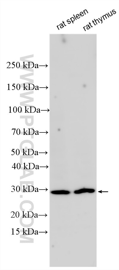 WB analysis using 34143-1-AP Western Blot (WB) analysis of various lysates using CD160 Polyclonal antibody (34143-1-AP)