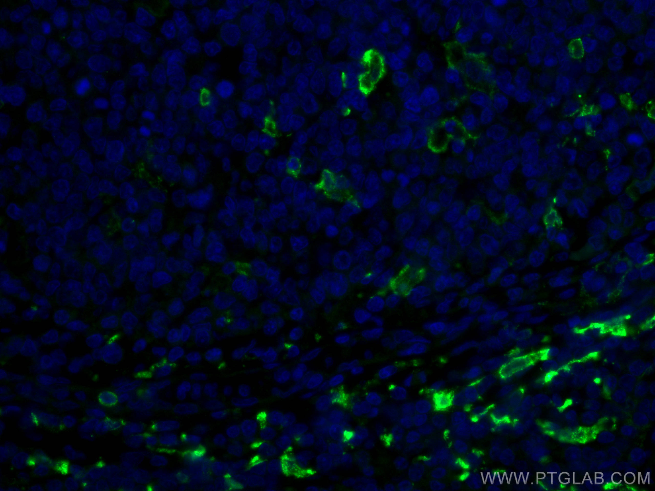 Immunofluorescence (IF) / fluorescent staining of human tonsillitis tissue using CD163 Polyclonal antibody (16646-1-AP)