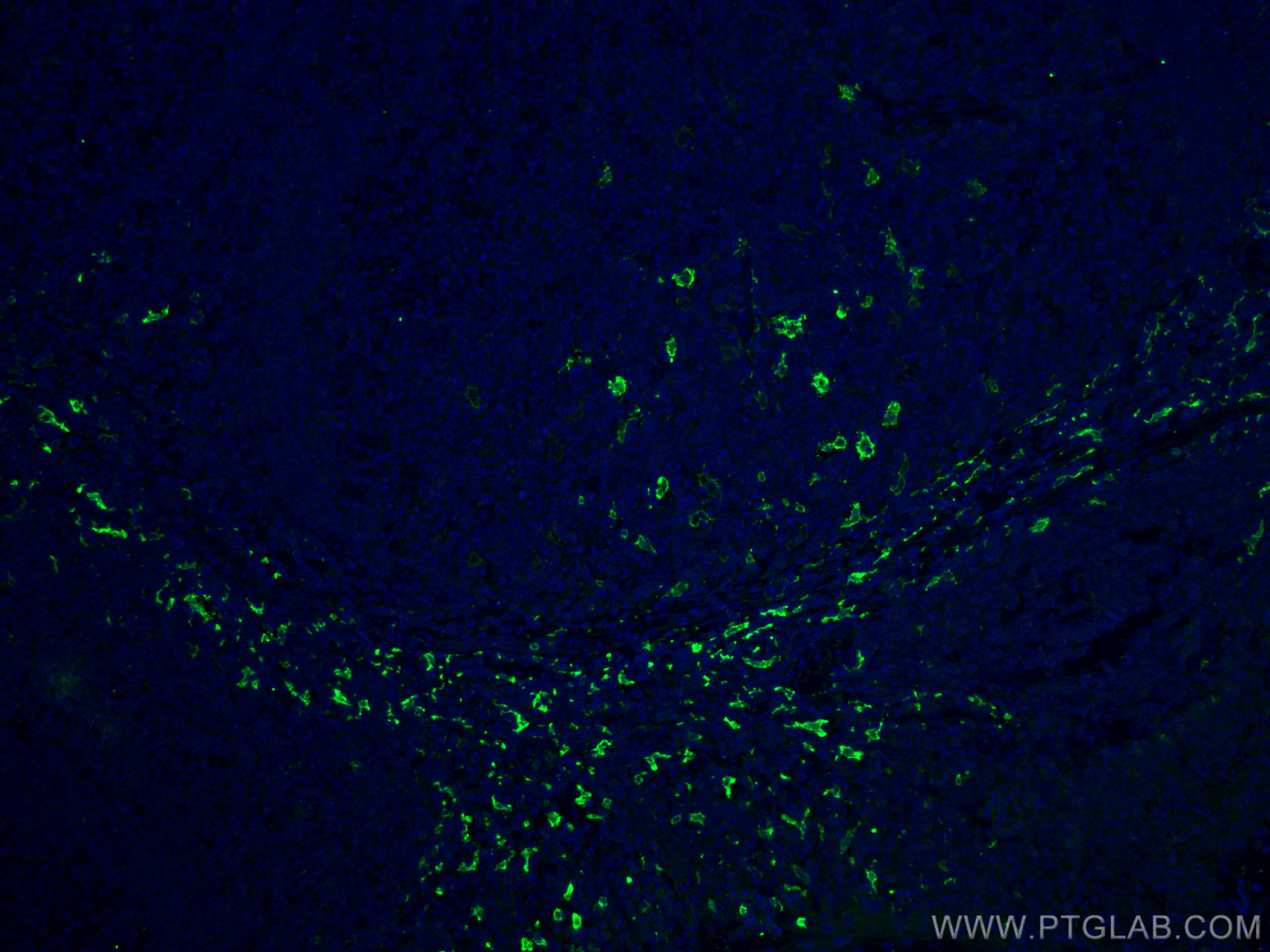 Immunofluorescence (IF) / fluorescent staining of human tonsillitis tissue using CD163 Polyclonal antibody (16646-1-AP)