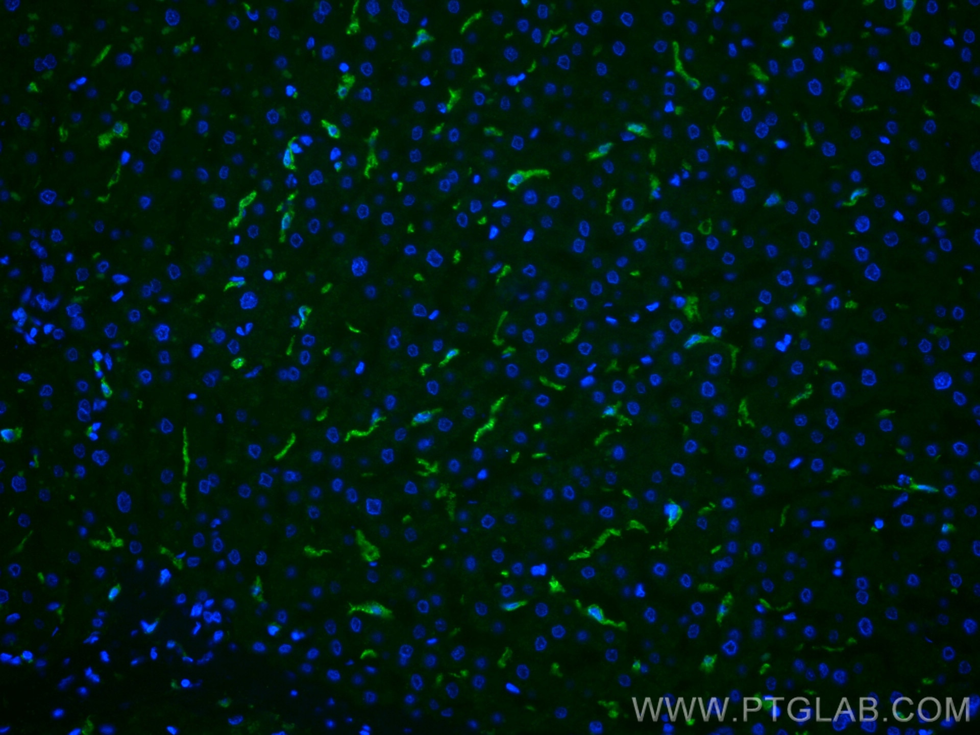 Immunofluorescence (IF) / fluorescent staining of human liver tissue using CD163 Polyclonal antibody (16646-1-AP)