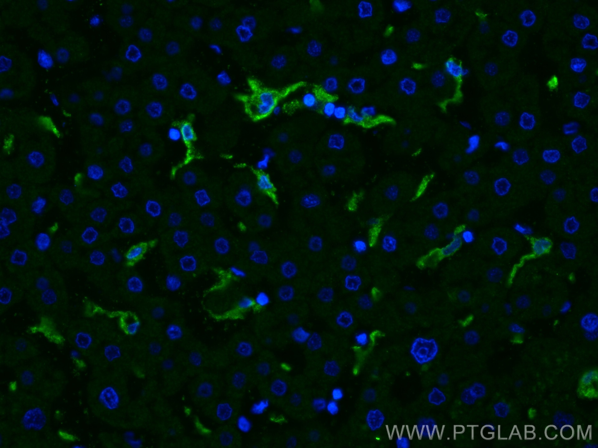 Immunofluorescence (IF) / fluorescent staining of human liver tissue using CD163 Polyclonal antibody (16646-1-AP)