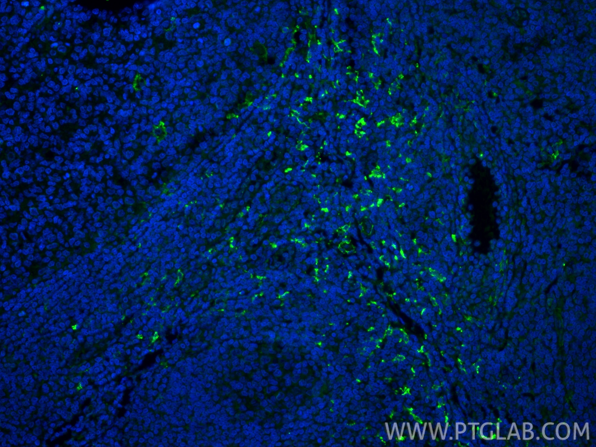 Immunofluorescent analysis of (4% PFA) fixed paraffin-embedded human tonsillitis tissue using CD163 antibody (16646-1-AP) at dilution of 1:400 and CoraLite®488-Conjugated Goat Anti-Rabbit IgG(H+L) (SA00013-2). Heat mediated antigen retrieval with Tris-EDTA buffer (pH 9.0). Immunofluorescence (IF) / fluorescent staining of human tonsillitis tissue using CD163 Polyclonal antibody (16646-1-AP)