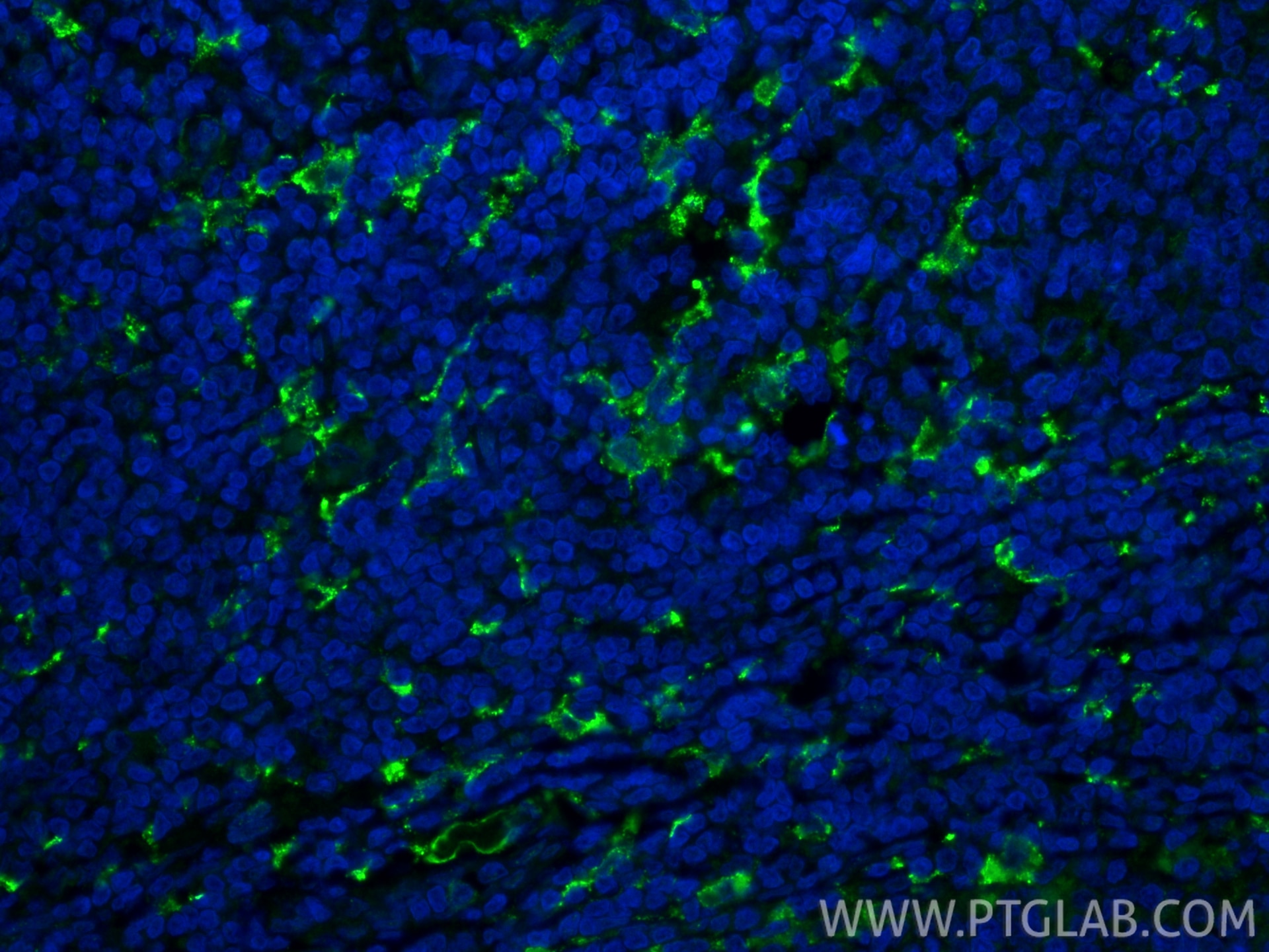 Immunofluorescent analysis of (4% PFA) fixed paraffin-embedded human tonsillitis tissue using CD163 antibody (16646-1-AP) at dilution of 1:400 and CoraLite®488-Conjugated Goat Anti-Rabbit IgG(H+L) (SA00013-2). Heat mediated antigen retrieval with Tris-EDTA buffer (pH 9.0). Immunofluorescence (IF) / fluorescent staining of human tonsillitis tissue using CD163 Polyclonal antibody (16646-1-AP)