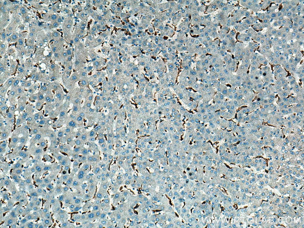 Immunohistochemistry (IHC) staining of human liver tissue using CD163 Polyclonal antibody (16646-1-AP)
