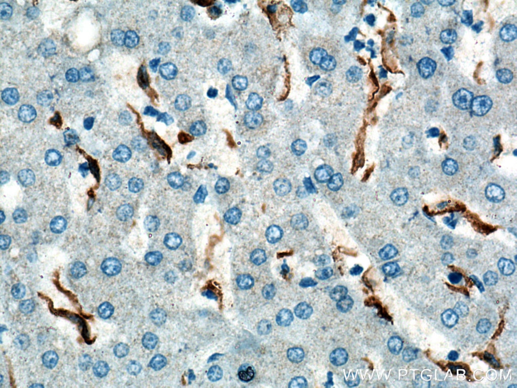 Immunohistochemistry (IHC) staining of human liver tissue using CD163 Polyclonal antibody (16646-1-AP)