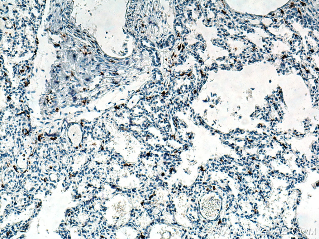 Immunohistochemistry (IHC) staining of human lung tissue using CD163 Polyclonal antibody (16646-1-AP)