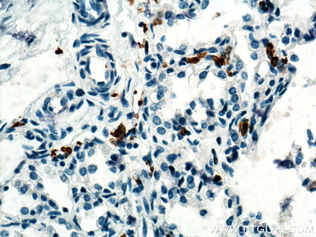 Immunohistochemistry (IHC) staining of human lung tissue using CD163 Polyclonal antibody (16646-1-AP)
