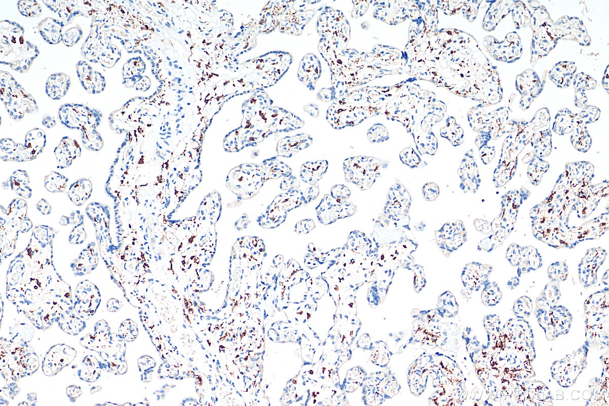 IHC staining of human placenta using 16646-1-AP